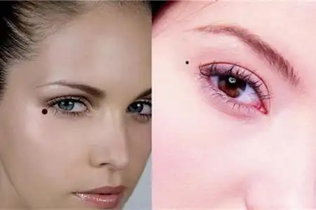 【图】眼角有痣 告诉你这个象征的含义