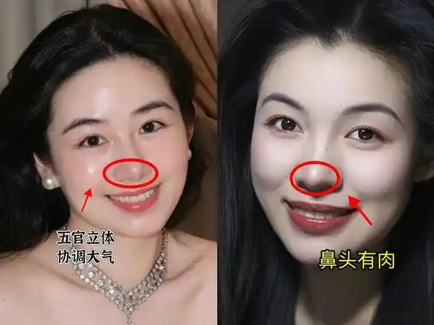 有一种长相叫"富贵脸",通常都有这3个特征,看看你有吗?