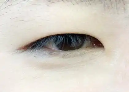 内双单眼皮也不丑 达人教你改变眼型