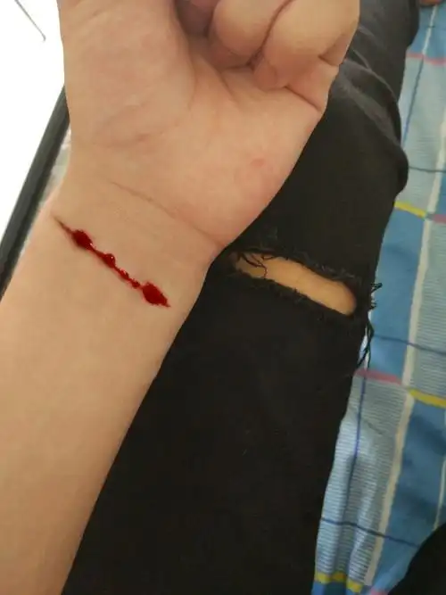 求ps大神帮我把p下图中伤疤p到另一张图上,后面再追加财富值