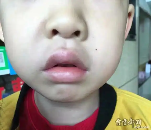 我的孩子怎么样变丑了? - 饮食健康 - 爱宜都网 - powered by discuz!