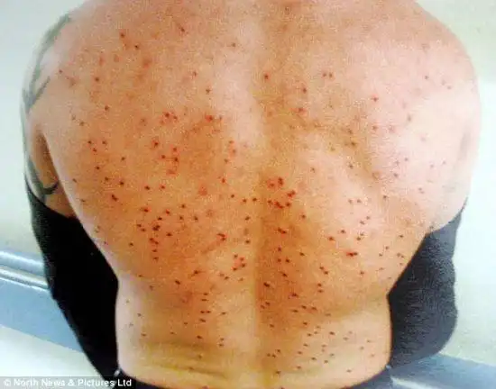 国际新闻 > 正文            我们听说过子弹留在体内几十年仍然平安