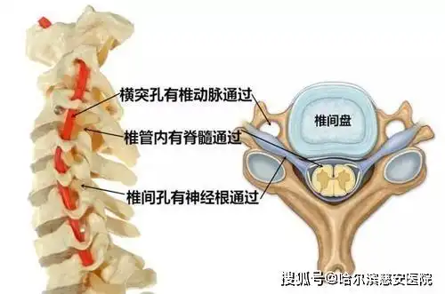 【科普】神经根型颈椎病_手机搜狐网