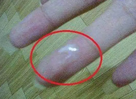 女人内裤有这样的分泌物,十有八九是怀上了,千万不要同房了