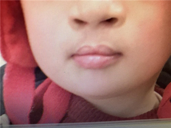 颠覆你的想象!这些曾经让人绝望的疾病,其实现在都能治