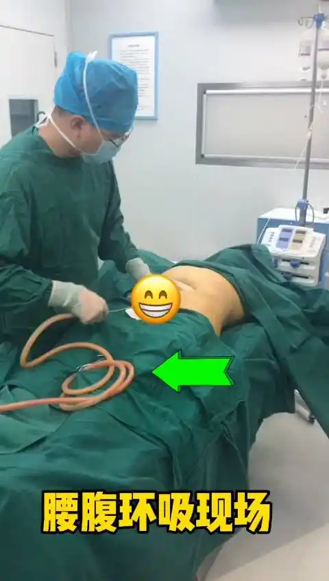 上午发了一个腰腹环吸的案例,大家有反馈术后短期出现"波浪纹"形态