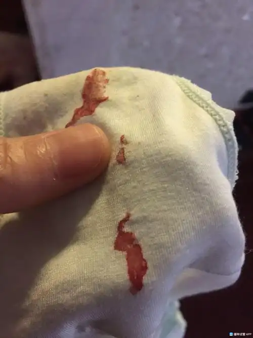 [试管婴儿]鲜胚移植第六天,刚发现内裤上有