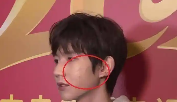 原创王源再次接受电视采访在照妖镜之下面部上痘痘很明显