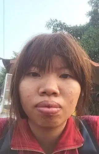 爆唇女相亲遭呛 整形后秒嫁富二代