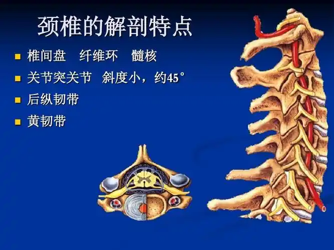 颈椎病护理查房ppt