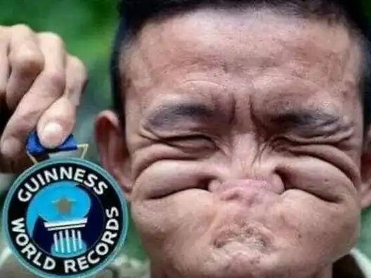 吉尼斯世界纪录这个丑男子平时的生活照还算清秀