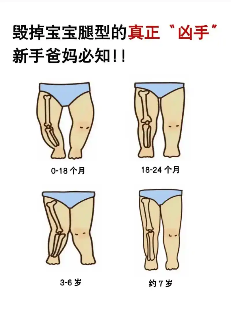 宝宝腿型发育每个阶段都有不 - 抖音