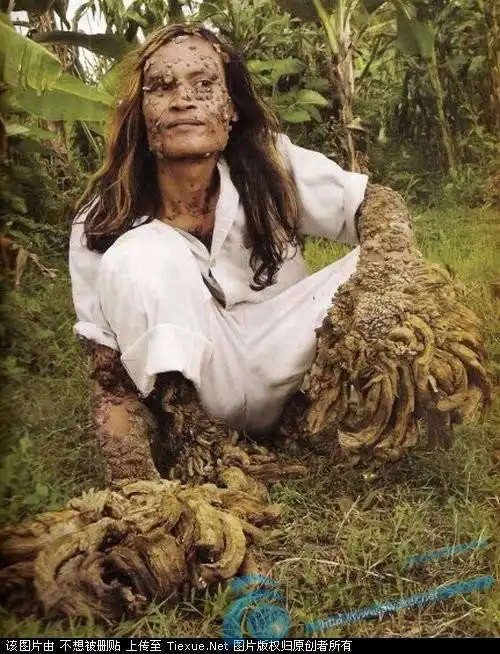 【引用】基因和变异(原创)