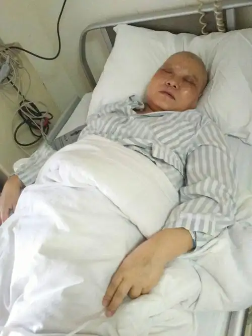 求助!帮助我患肺腺癌晚期的妈妈!