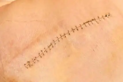 红色的伤口图片-红色的伤口素材-红色的伤口插画-摄图新视界