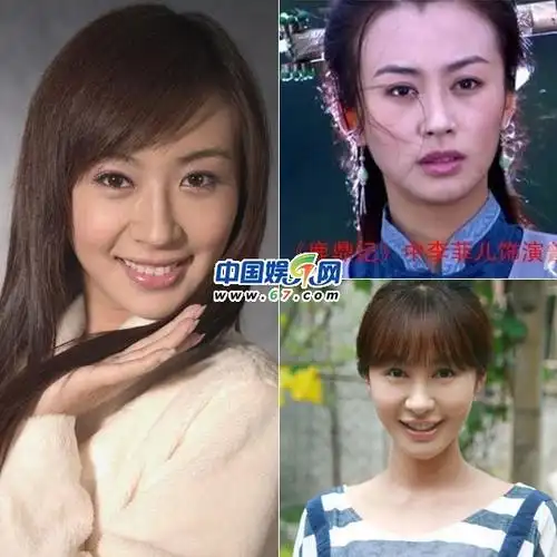 李菲儿数度整容曾恋黄晓明与权相佑苏醒传绯闻