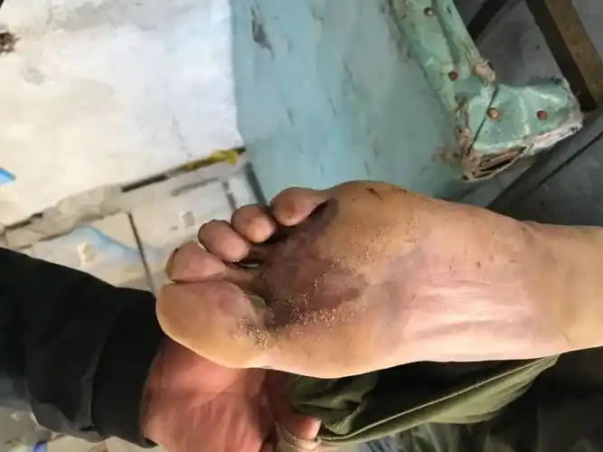 高压线下莫建房河北一男子建房触电身亡现场照片可能引起不适慎入