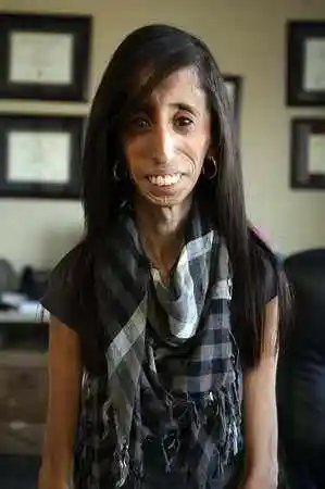 利兹·维拉斯奎兹(lizzie velasquez)被称作"全世界最丑的女人本文由