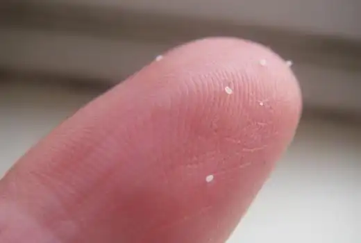 跳蚤的卵长什么样图