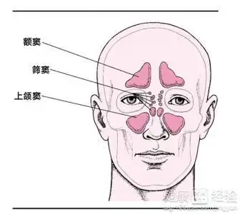 急性上颌窦炎会引发什么疾病