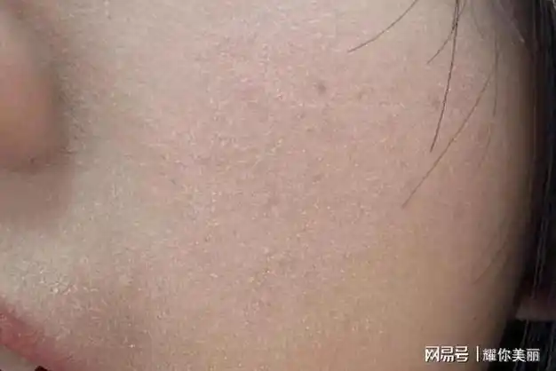 来试试这些方法吧|面霜|去角质|保湿精华|皮肤粗糙|肌肤暗沉|敏感肌肤