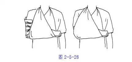 三角巾上放杂志或书本,前臂置于书本上即可.