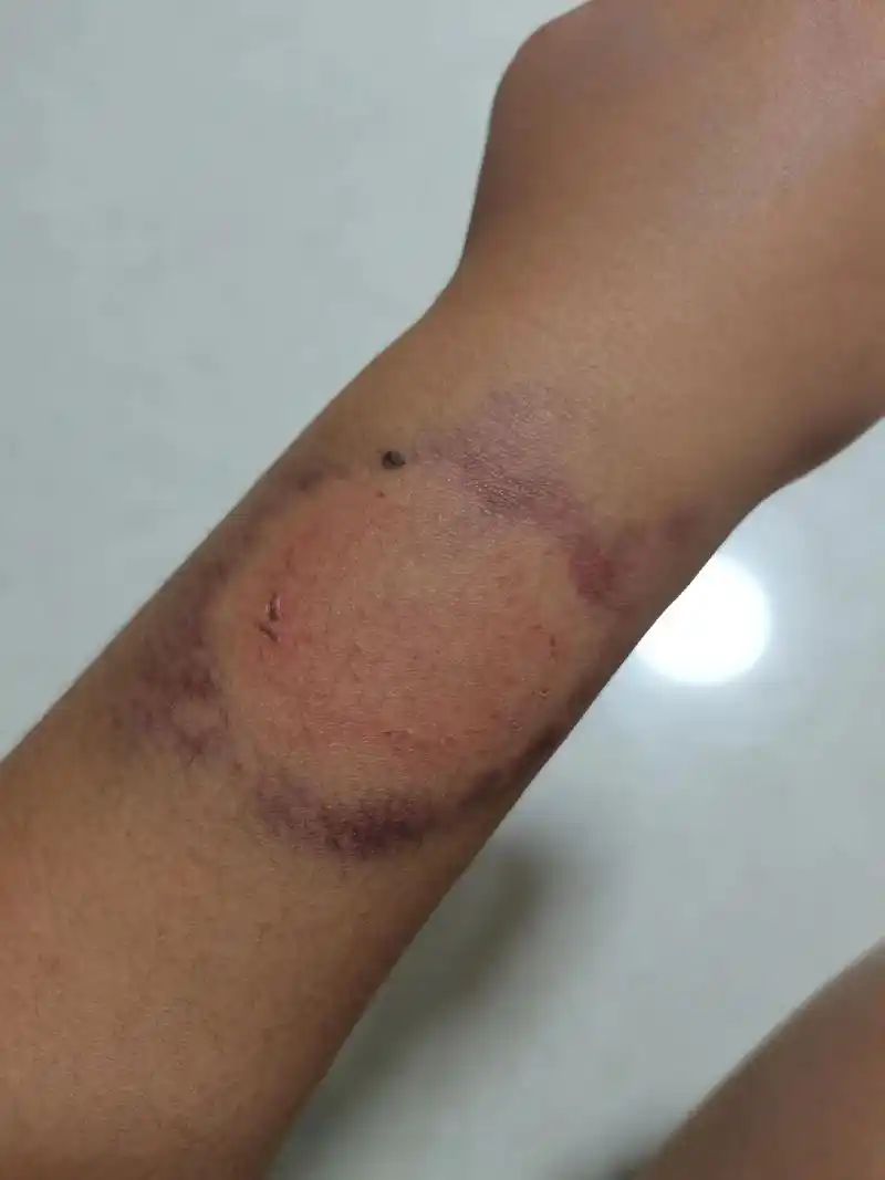 不是说自己全程没打人吗?这 - 抖音