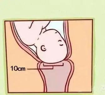 顺产宫口开十指别真以为是十根手指宽