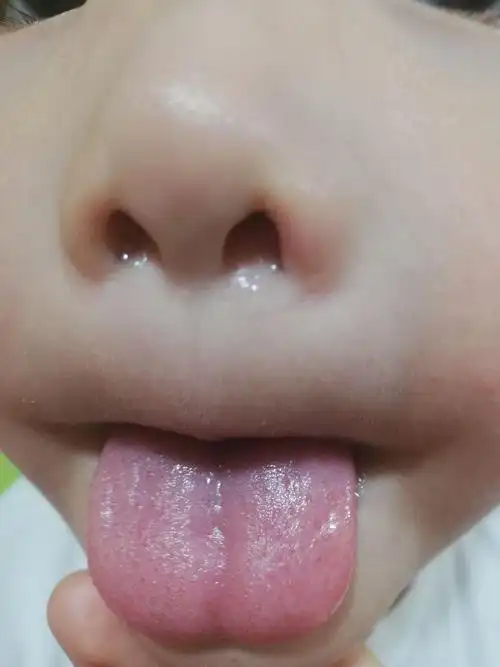 宝宝舌苔面相记录