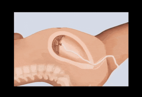 一张图告诉你生孩子"开十指"是怎么开的,没人能笑着看完……_妈妈