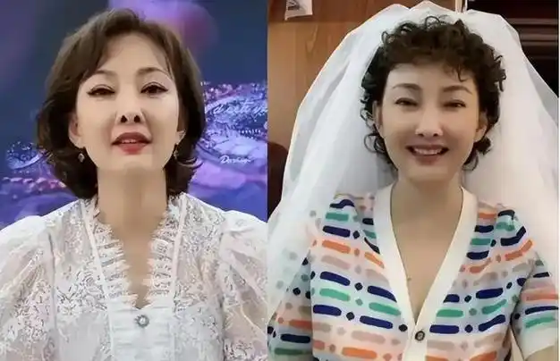 难相信眼前脸就像是肿起来一样的女人,竟然是曾经惊艳了无数人的牛莉