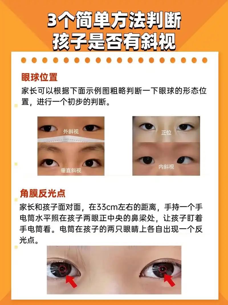 简单30秒教你自测眼睛斜视.#斜视 #自测斜视 #硬核健康科 - 抖音