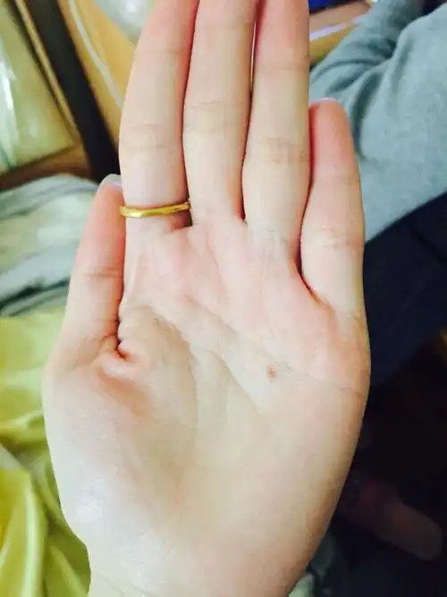 朱砂痣长什么样 (血痣和红痣的区别图片)-第1张图片-珑钦运势网