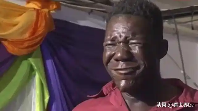 非洲"最丑"的人,5次选丑4次夺冠,看完有些吃不下饭_网易订阅