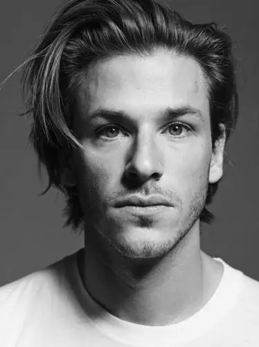 法国男演员,代表作《少年汉尼拔》《圣罗兰传》 脸颊上有一道后天造成