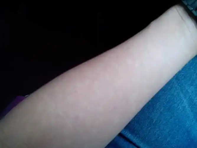 胳膊上这样的白点点是汗斑么?