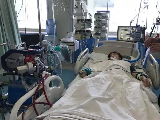 淮南市首例ecmo手术在我淮南东方医院总院icu开展