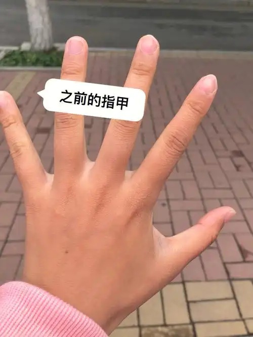 本人手小指甲小(忽略手黑),我看有很多养甲床,游离线的方法都是每天抹