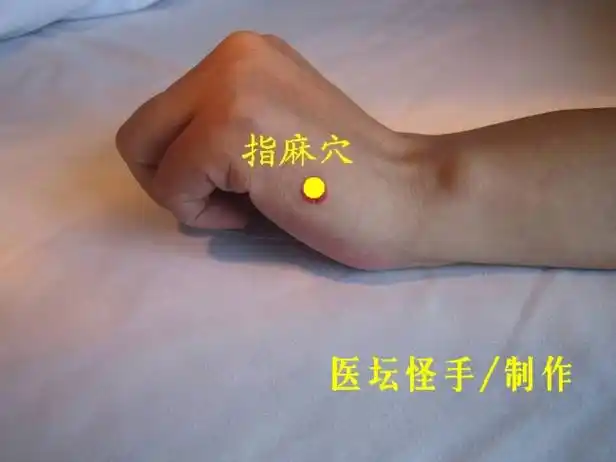 王文远平衡针灸穴位图共38穴