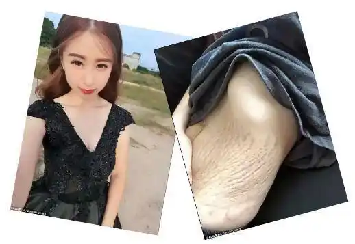 23岁辣妈晒肚皮照吓坏网友!其实产后肚子能这样恢复