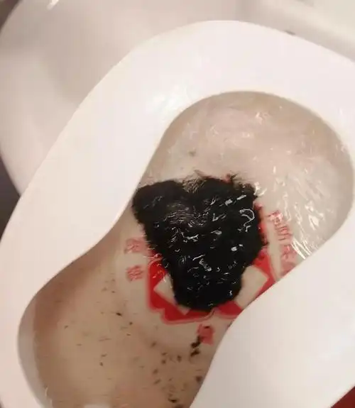 恶心想吐的大便图片,宝宝阵发性哭吵,大便像"果酱",警惕肠子"打结"