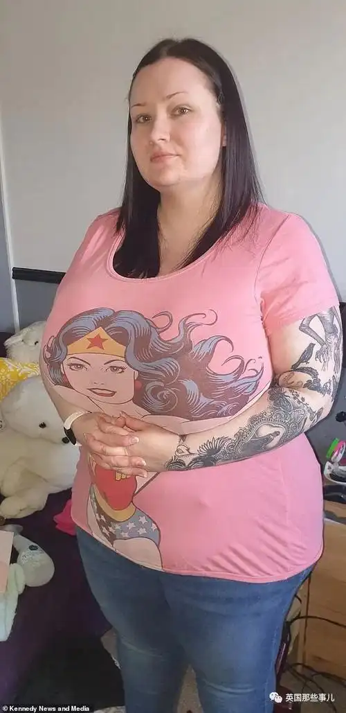 英国妹子长38p罩杯巨胸背痛溃疡还饱受嘲笑却被拒绝手术