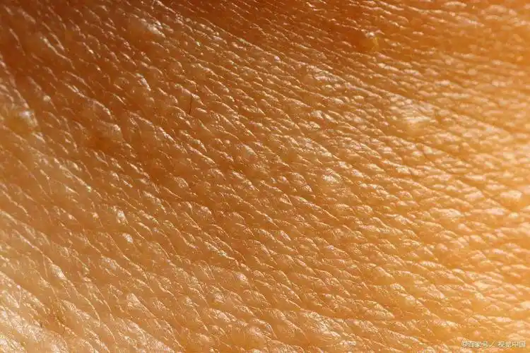 皮肤_脂肪_生活