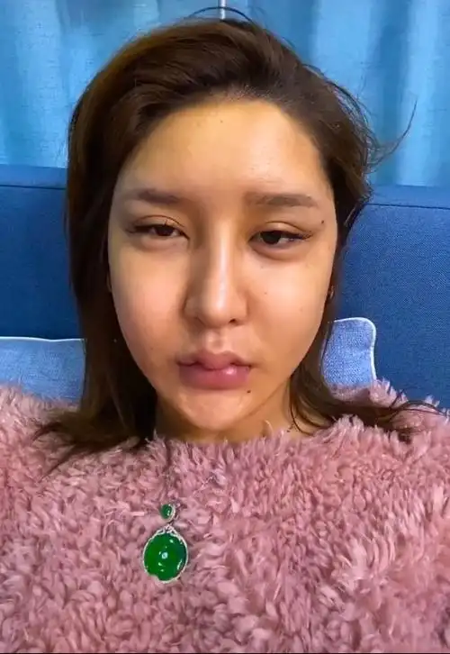 整容全脸大概多少钱啊整容8年花了100多万