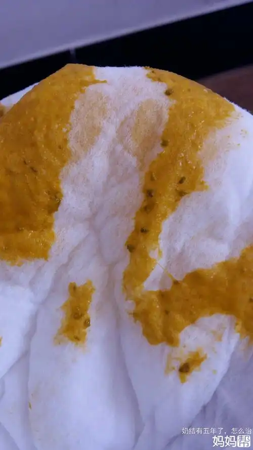 大便颗粒状怎么办 大便颗粒状怎么办?