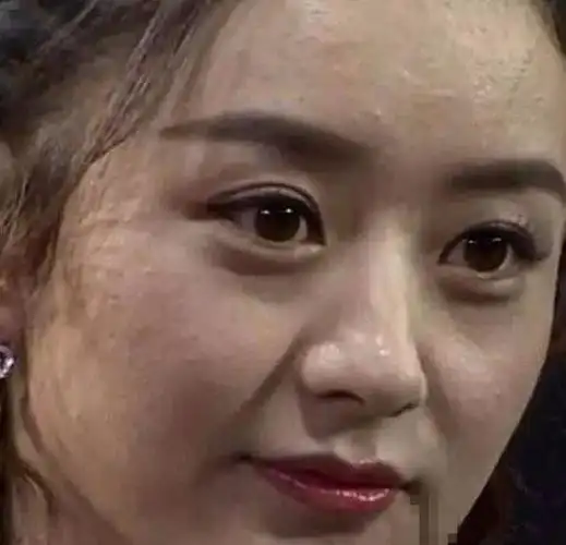 早年不注意保养的时候,离开了ps之后,额头,脸上也有不少痘痘呢