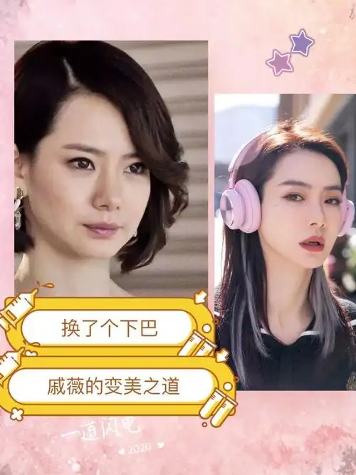 短的明星下巴后缩严重的明星戚薇以前照片明星下巴假体下巴后缩图片