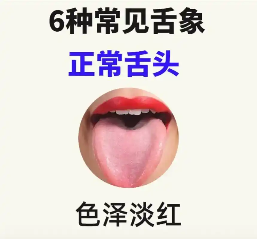 快来对照一下自己的舌头.#养生知识 #古人的智慧 #舌诊 - 抖音