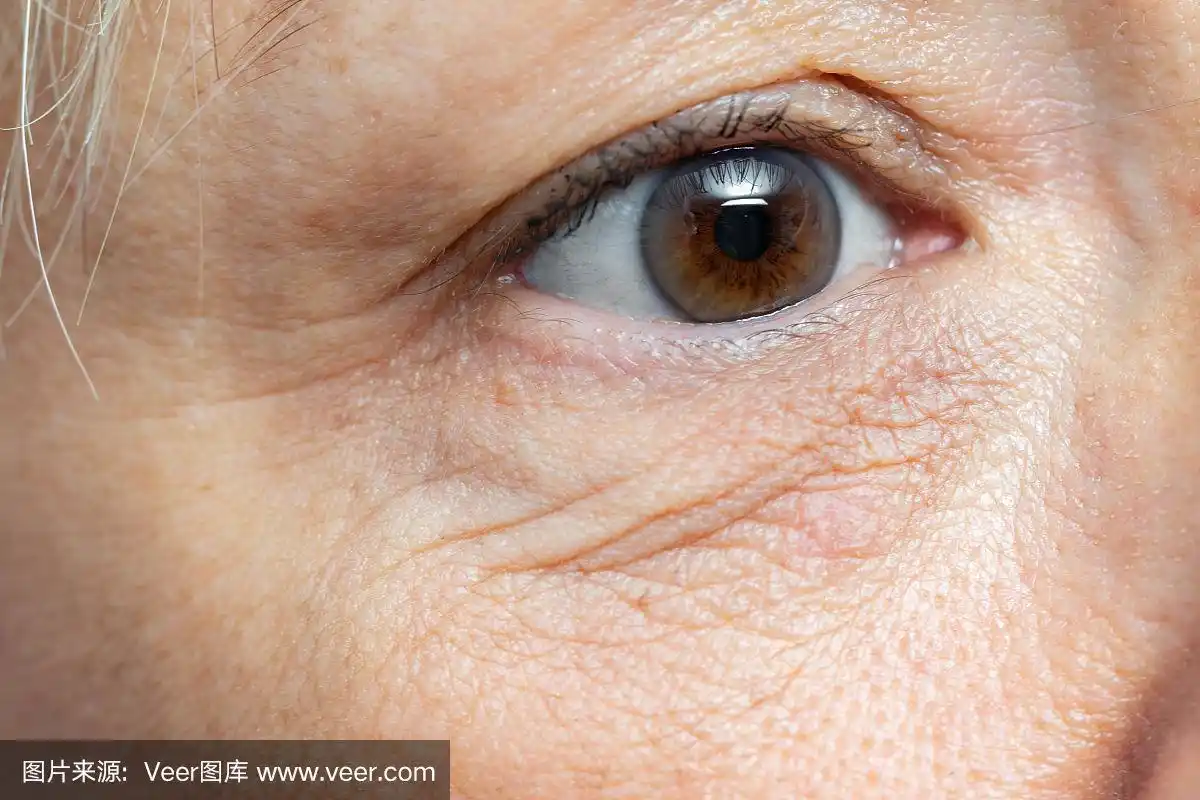 中年妇女眼部皱纹的微距细节.