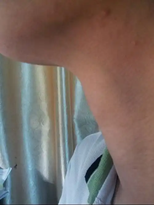 男生15岁,喉结这样子了,还会长高吗?